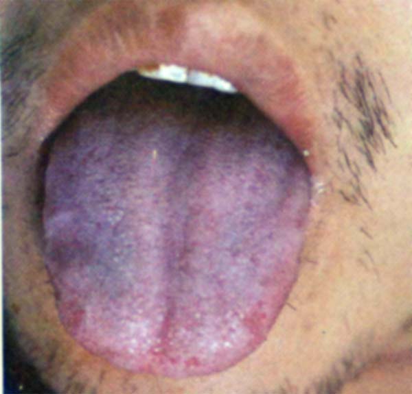 青紫舌的高清图片