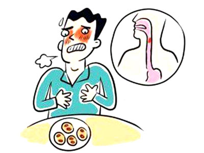 食管癌漫画图片